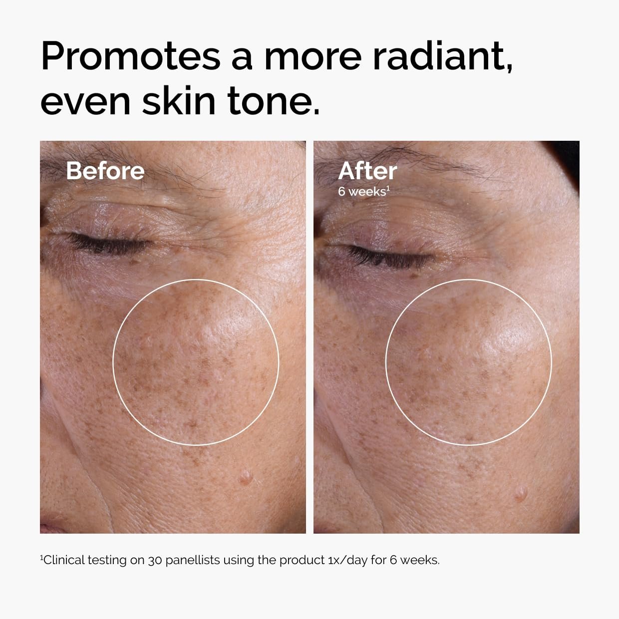 The Ordinary Glycolic Acid 7% Exfoliating Toner – Daily Brightening & Smoothing Toner for More Even-Looking Skin Tone, Gentle Chemical Exfoliant for Face - Image 2